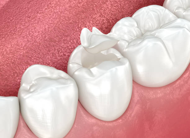 Reliable North Lauderdale, FL  Dental Services Solutions